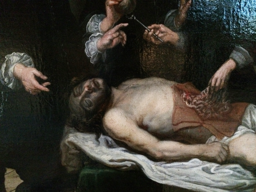 The Anatomy Lesson, Anonymous, Bruges, 1679